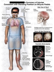 Summary of Traumatic Injuries