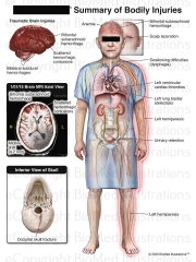 Summary of Traumatic Injuries