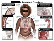 BioMed-Illustrations-Portfolio-of-Exhibit-Examples_Page_04