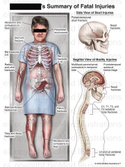 Summary of Fatal Injuries