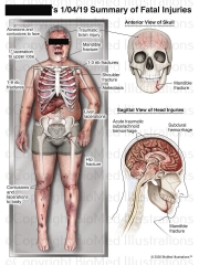 Summary of Fatal Injuries