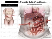 Summary of Fatal Bullet Wound Injuries